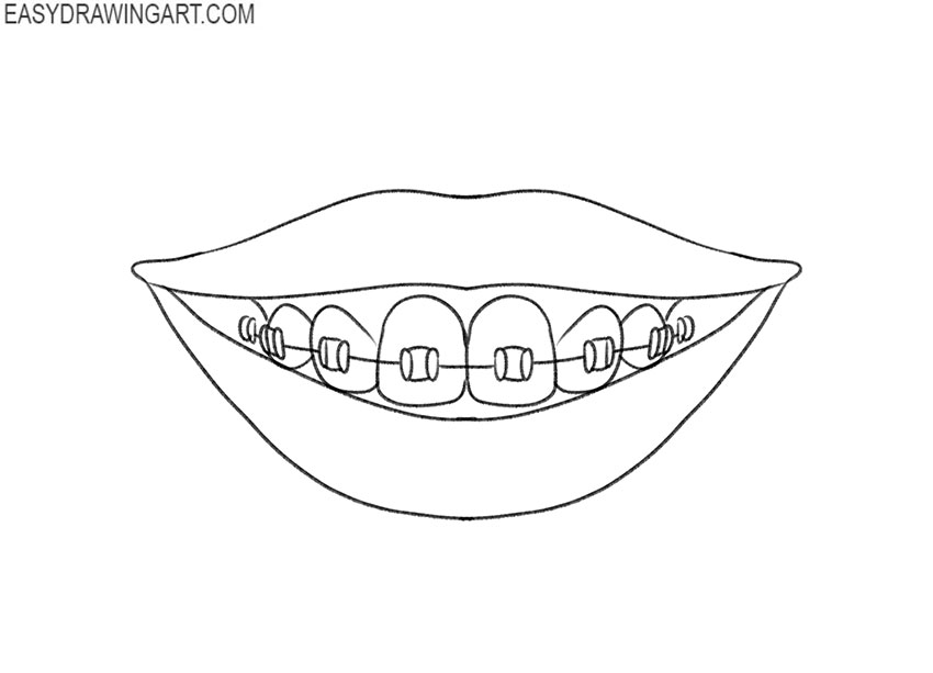 braces drawing lesson