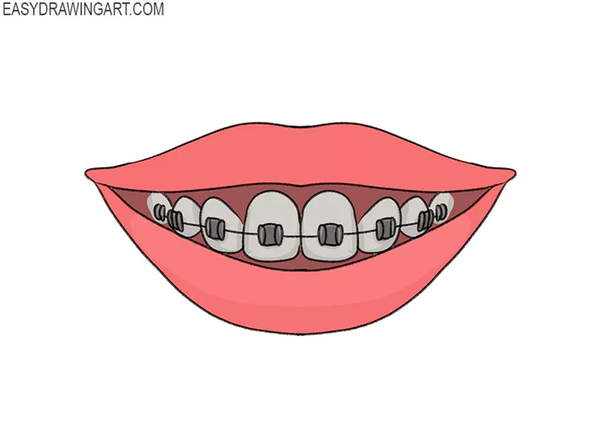 How to Draw Braces Easy Drawing Art