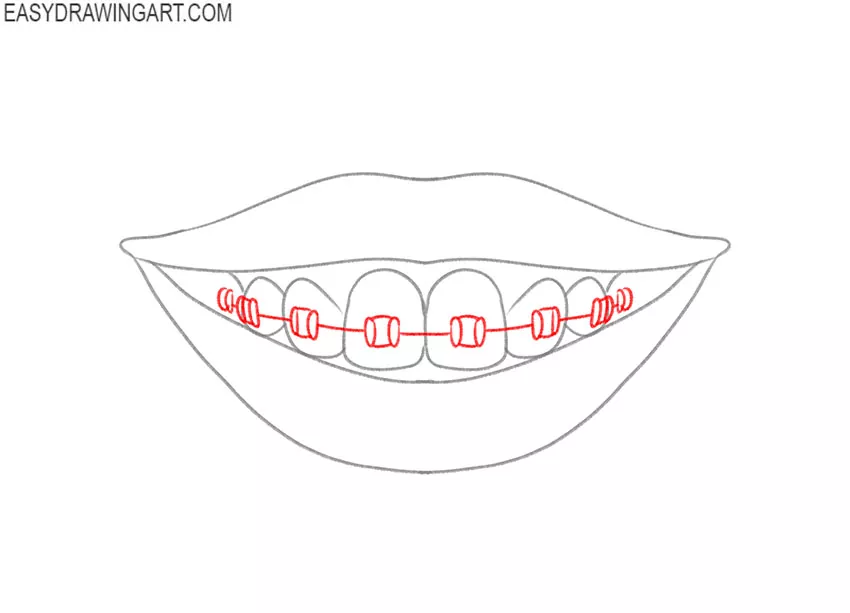 how to draw a smile with braces